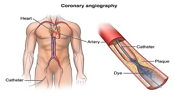 cardiac health checkup in parel mumbai
                                    